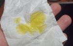 Желтая вода из носа — что означает и какие причины появления, все о гомеопатии