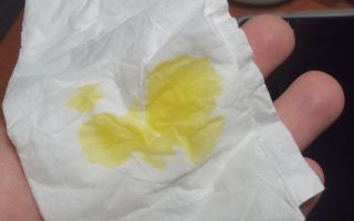 Желтая вода из носа — что означает и какие причины появления, все о гомеопатии