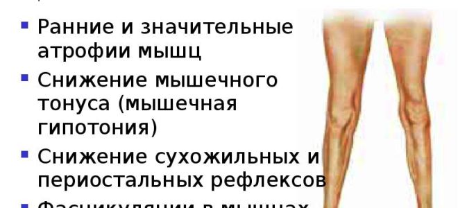 Что такое парез конечностей и как лечить его гомеопатией — список препаратов, все о гомеопатии