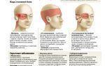 Причины болей в макушке головы (в теменной части) — лечение проблемы, все о гомеопатии