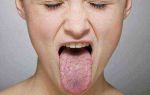 Горечь во рту по утрам — причины появления и лечение, все о гомеопатии