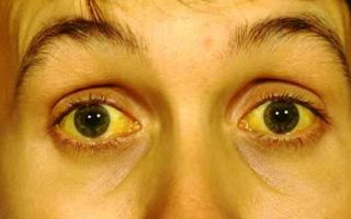 Желтизна (желтая или зеленая кожа) вокруг рта — все о гомеопатии