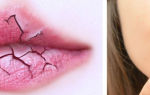 После кашля привкус железа во рту — какие факторы влияют на вкус, все о гомеопатии
