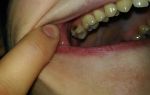 Болит зуб при ходьбе — разберемся в причинах, все о гомеопатии