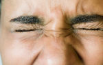 Частое моргание глазами — устанавливаем причину, все о гомеопатии