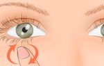 Дергается глаз (правый) — причины и лечение, все о гомеопатии