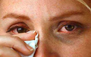 Боль в уголках глаз — выясняем причины, все о гомеопатии