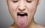 Горечь и сухость во рту — какие причины, все о гомеопатии