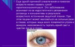 Слезятся глаза — причины офтальмологического нарушения, все о гомеопатии
