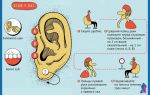 Что делать, если заложило ухо и по каким причинам? — можно ли устранить проблему самостоятельно, все о гомеопатии