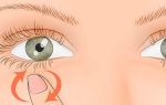 Дергается верхнее веко глаза — что можно предпринять, все о гомеопатии