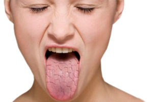 Кислый запах изо рта — верный признак проблем с желудком, все о гомеопатии