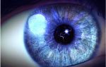 Вспышки света в глазах — почему в глаза возникают световые вспышки, все о гомеопатии