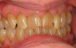Желтые зубы — разберем все причины, все о гомеопатии