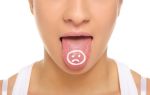 Немеют язык и губы — что делать при таком симптоме, все о гомеопатии