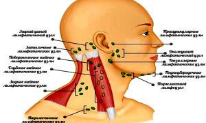 Боль под ухом и в шее: что это значит и что делать? — все о гомеопатии